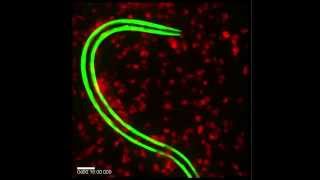 Eosinophils Sticking to a Worm [upl. by Mitchiner]