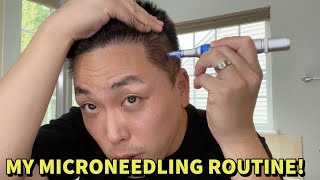 MY MICRONEEDLING ROUTINE TO TREAT HAIR LOSS [upl. by Collayer]