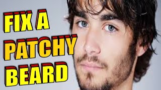 How To Fix A Patchy Beard NATURALLY FAST amp CHEAPLY At Home [upl. by Ynohtnaeoj]