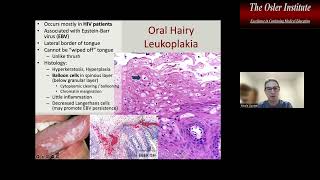 Osler Anatomic Pathology Online Review 2022 Sample [upl. by Richer]