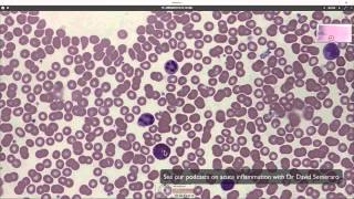 What blood looks like down the microscope [upl. by Gelman768]