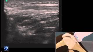 How To Ultrasound Exam of the InfraPatellar Tendon 3D Video [upl. by Analaj]