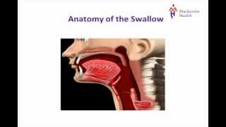 Stroke Education  Dysphagia [upl. by Nalim]