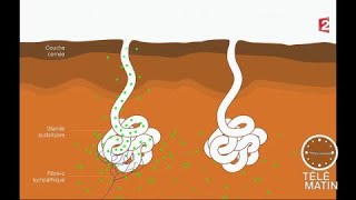 Santé  Quand la sueur prédit le diabète [upl. by Romanas]