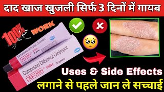 derobin cream kis kaam mein aata hai  derobin cream uses in hindi  derobin  dad khaj khujali [upl. by Eeliah]