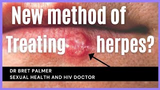 Possible new treatment for herpes [upl. by Oynotna]