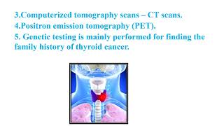 Thyroid cancer Video No 608 [upl. by Riabuz]