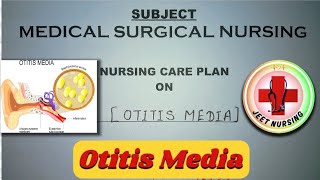 Nursing Care Plan on Otitis Media  Case study on Otitis Media nurshing medical ncp [upl. by Harl]