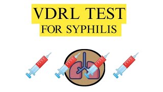 VDRL test  VDRL test for syphilis Venereal Disease Research Laboratory Test [upl. by Yeo27]