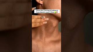 😱Neck Cleaning TipsDark Neck Home RemediesTanning Removal Tips beautytipsskincareshortsviral [upl. by Voorhis]