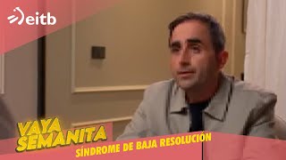 VS Síndrome de baja resolución vayasemanita [upl. by Bobinette]