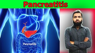 Pancreatitis  causes symptoms diagnosis treatment pathology  lecture In Urdu amp Hindi [upl. by Jamill]