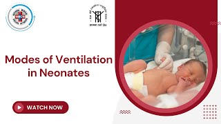 Modes of Ventilation in Neonates [upl. by Oninrutas254]