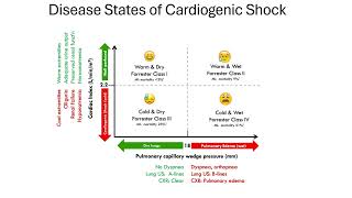 cardiogenic shock [upl. by Marcy]