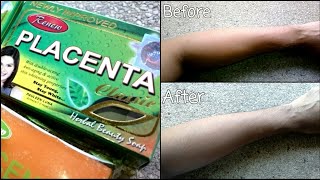 Renew Placenta Whitening and Anti Aging Soap Review [upl. by Alarice]