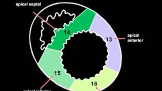 Volodymyr Pavliuk MD PhD Echocardiographic Assesment of Left Ventricular Systolic Function [upl. by Dloraj]