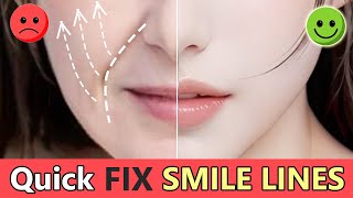 Quick Remove Smile lines Nasolabial Fold Lift Saggy Cheeks Fill Cheek lines  Face Rejuvenation [upl. by Adraynek]