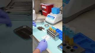 IN OFFICE IV INFUSION AND PHLEBOTOMY prfedu skincare ivf infusion prf prfedu phlebotomy [upl. by Akiam]