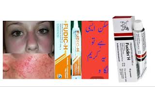 fucidin H cream usesSide EffectsDosage review in Hindi or Urdu [upl. by Siger]