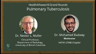 Imaging of Pulmonary Tuberculosis [upl. by Reiniar]