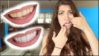 How to Whiten Teeth in 2 Minutes guaranteed whiten teeth [upl. by Sandell254]