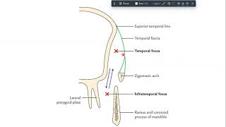 infratemporal fossa anatomy [upl. by Nylle]