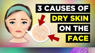 3 Causes Of Dry Skin On The Face Dry Skin Remedies [upl. by Anitrebla]