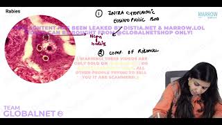 CNS  NON NEOPLASTIC LESIONS By Dr Illa jain khandelwal Pathology by Marrow Video Lecture [upl. by Ecitnirp470]