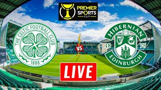 Celtic vs Hibernian Live Stream  Scottish League Cup  Hibernian vs Celtic Live [upl. by Peppie]