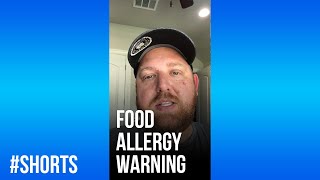 How Does Your Restaurant Handle Food Allergies shorts [upl. by Rubina929]