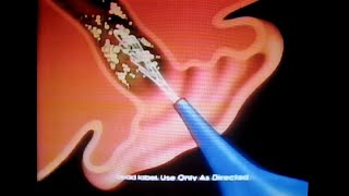 Murine Ear Wax Removal System commercial Family Channel March 10 1992 [upl. by Atteynek]