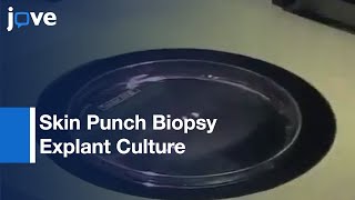 Skin Punch Biopsy Explant Culture For Derivation Primary Human Fibroblasts l Protocol Preview [upl. by Hayila]