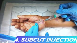 StepbyStep Guide Administering Local Anaesthesia for Carpal Tunnel Decompression [upl. by Annaujat531]