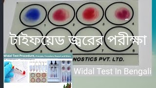 Widal Test Typhoid Paratyphoid Test Widal Test In Bengali Widal Test In BanglaLab Technician Rajib [upl. by Annawoj114]