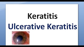 Ophthalmology 110 a Keratitis Cornea Inflammation Corneal Ulcer Ulcerative Ulceration [upl. by Saxet]