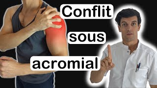 Conflit sous acromial vous devez savoir ça [upl. by Nivla]