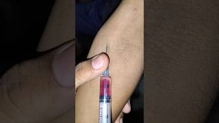 Iv injection basic information about nursing ytshorts shorts nursing trending viralshort [upl. by Yesor]