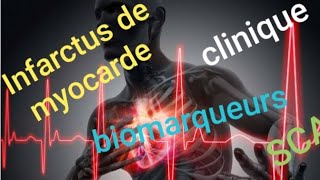 Cours Infarctus de myocarde IDM PARTIE 1 [upl. by Harmonie]