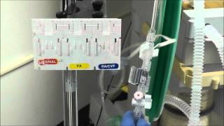 How to Setup an Arterial Line Transducer [upl. by Ikila264]