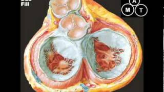 Animated Mitral Regurgitation Murmur [upl. by Crespo]