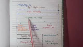 IgA Nephropathy  Pathology [upl. by Bovill715]