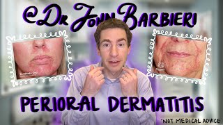 Dermatologist Explains Perioral Dermatitis How to Identify Causes amp Treatment [upl. by Eriha]