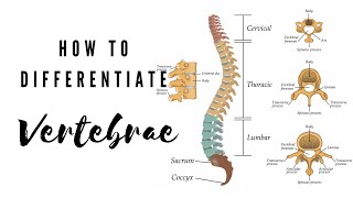 How to differentiate Vertebrae  Viva Voce of Anatomy [upl. by Jarred]