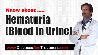 Hematuria Blood In Urine  Causes Diagnosis Symptoms Treatment Prognosis [upl. by Bander386]