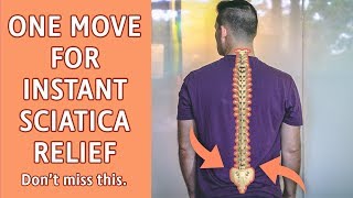 One Movement for Instant Sciatica Pain Relief [upl. by Neladgam]