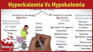 Hyperkalemia Vs Hypokalemia  EASY TO REMEMBER [upl. by Agace976]