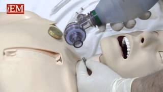 Simple Needle Cricothyroidotomy Options [upl. by Attela]