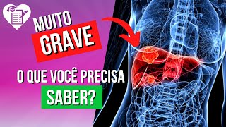 HEPATITE B  Sintomas Transmissão Tratamento e Cura [upl. by Ellebanna]