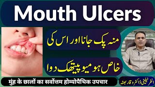 Mouth Ulcers منہ پک جانا मुँह के छाले Homeopathic Treatment in Urdu  Hindi [upl. by Aenad]