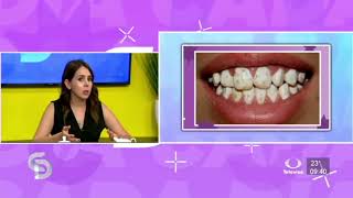 CD Dentista Amelogénesis imperfecta [upl. by Ailimat]